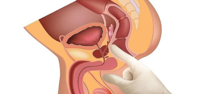 Простаторея: основные характеристики патологического состояния