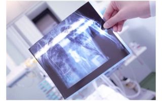 Показания для проведения компьютерной томографии грудной клетки