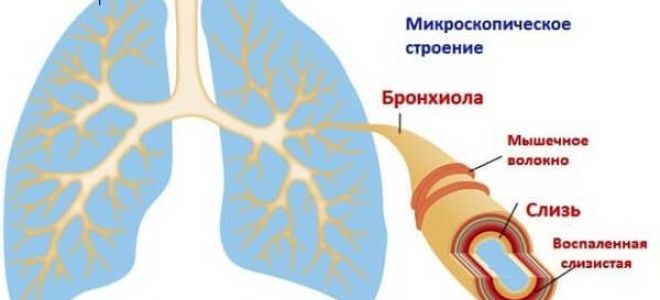 Сухой кашель и температура 38 у взрослого: как облегчить состояние