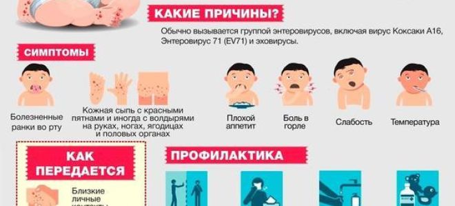 Симптомы заражения вирусом коксаки и профилактика заболевания