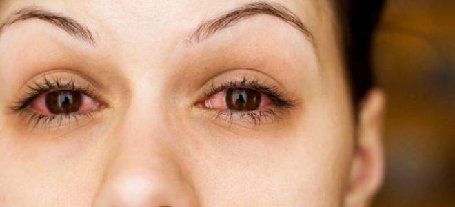 Причины появления глаукомы и подходы к лечению заболевания