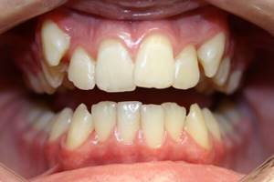 Лечение каких патологий зубов входит в компетенцию ортодонта
