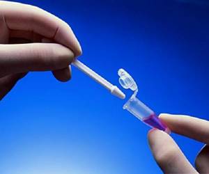 ВПЧ генотипирование: особенности и варианты проведения с пояснением