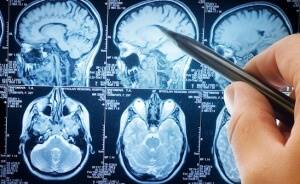 Как проходит обследование у нейрохирурга после травмы головы