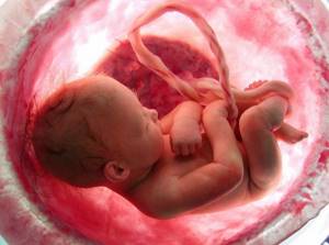 Папилломы у новорожденного: подходы в распознании и лечении