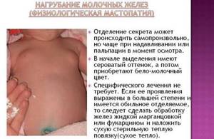 Мастопатия новорожденных: причины появления и особенности течения