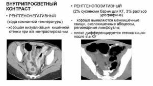 Этапы проведения компьютерной томографии органов малого таза