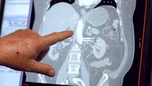Проведение компьютерной томографии органов брюшной полости