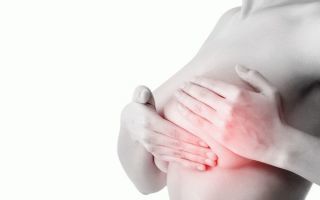 Признаки мастопатии молочных желез и их особенности при климаксе
