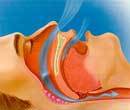 Почему человек храпит и как лечить нарушение дыхания во сне