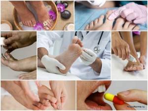 «Стоп Актив» от грибка ног: эффективный способ борьбы с болезнью