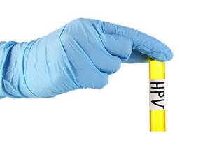 Вирусная нагрузка ВПЧ: этапы проведения и нормативные значения