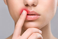 Симптомы герпеса на губах и методы лечения инфекционной болезни