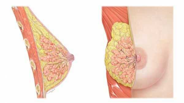 Инволютивная мастопатия: причины появления и клинические признаки