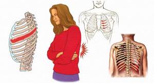 При каких патологиях появляется кашель и боль в грудной клетке