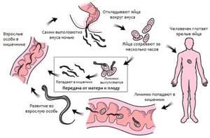 Симптомы гельминтоза и профилактика заражения паразитами