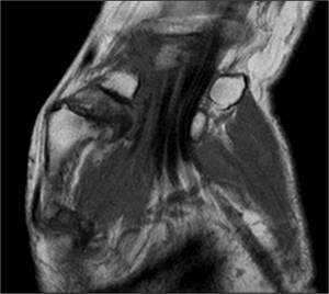 Магнитно-резонансная томография лучезапястного сустава и кисти
