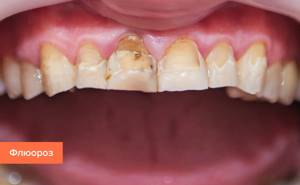 Помощь стоматолога при развитии заболеваний зубов и полости рта