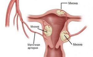 Боровая матка при мастопатии: свойства и оказываемый эффект