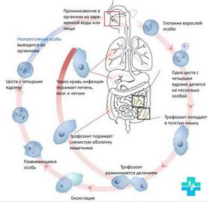 Симптомы амебиаза и основные подходы в лечении заболевания