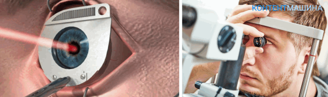 Лечение миопии глаз консервативным и хирургическим методом