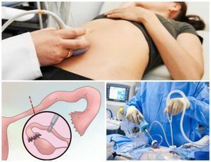 Симптомы внематочной беременности и способы лечения патологии